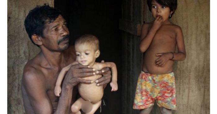 ভারতের ৭৬ শতাংশ মানুষের পুষ্টিকর খাবার জোটে না